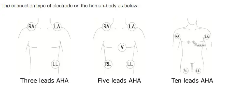 Fios de ECG de 5 derivações para philips digitrak plus holter 24 horas 3100A, 5 derivações, Snap